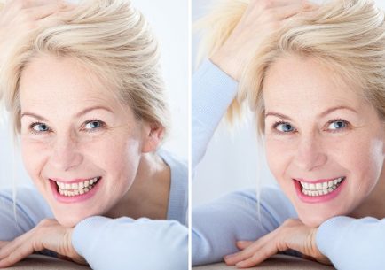 A nap hatása a bőr öregedésére - Anti-Aging és Orvos-Esztétikai Blog